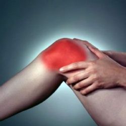 Síndrome de la cintilla iliotibial o «rodilla del corredor»