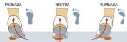 Zapatillas pronadoras, supinadoras o neutras. ¿Es útil el análisis de la pisada?