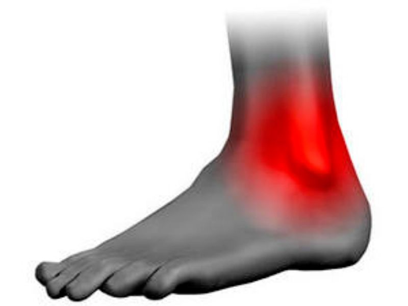 Esguince de ligamento deltoideo