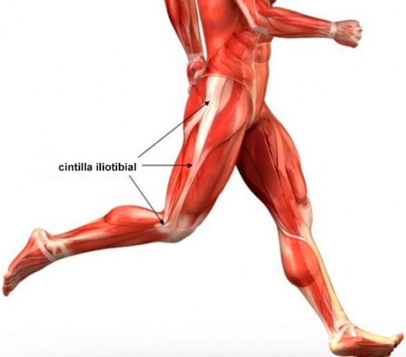 Lesiones del Corredor: Síndrome de la cintilla iliotibial