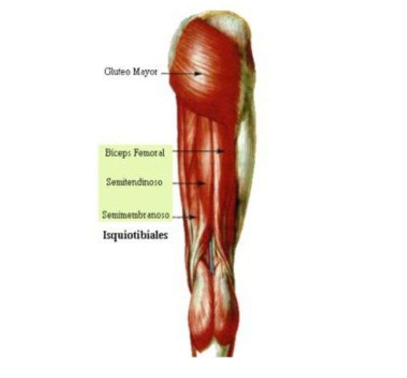 Rotura de isquiotibiales