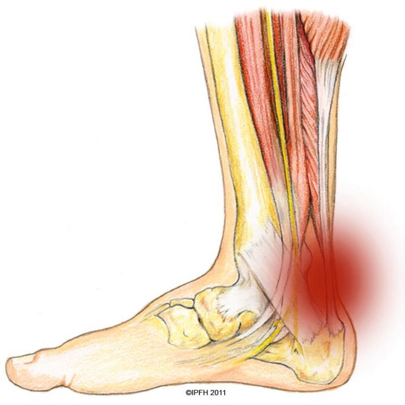 dureri la nivelul articulațiilor genunchiului cu artroză durerea în articulația genunchiului nu îndoaie piciorul